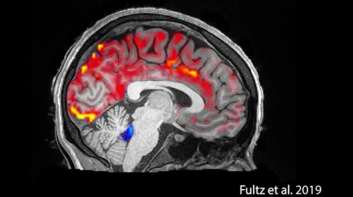 spinal fluid brain sleep